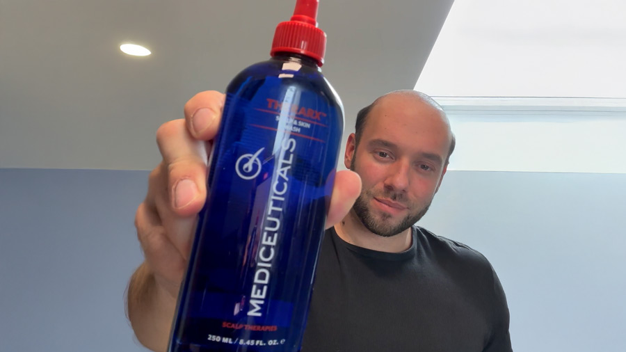 Haarsystem-Kopfhautpflege Kopfhautpflege mit Haarsystem und Mediceuticals